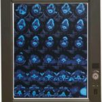 Negatoscopio sencillo LED MP-ZG1 (SOBRE PEDIDO)