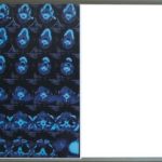 Negatoscopio doble LED MP-ZG2 (VENTA SOBRE PEDID0)